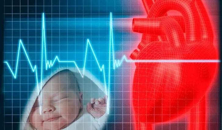 Врожденные пороки сердца - клинические рекомендации
