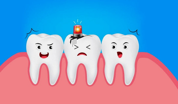 Кариес зубов - лечение, профилактика