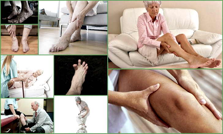 Ночные судороги в ногах, причины и лечение
