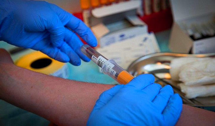 Тест на ВИЧ в лаборатории