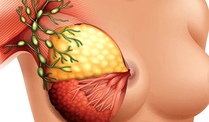 воспаление лимфоузлов в грудных железах у женщин симптомы и лечение